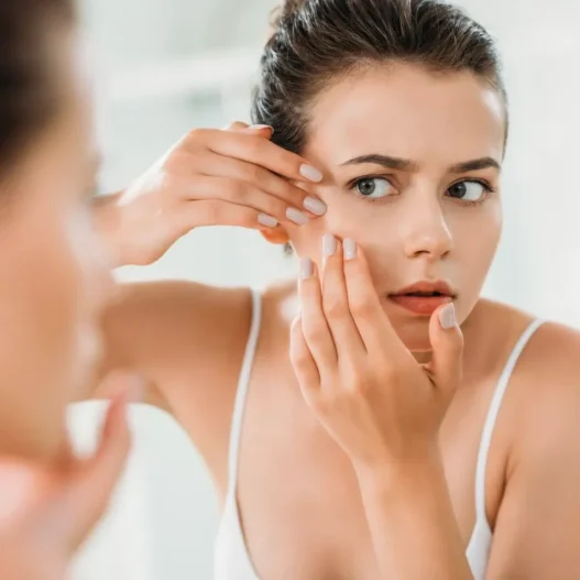 Closed Comedones and Clogged Pores A Dermatologist Reveals the Definitive Strategy to Banish Subsurface Bumps