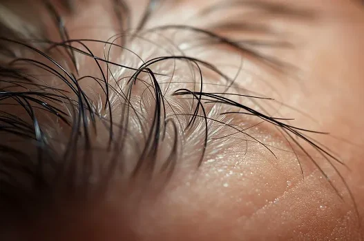 Understanding and Combatting Unpleasant Scalp Odor